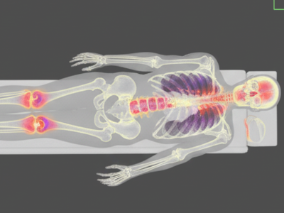 Nuclear Medicine